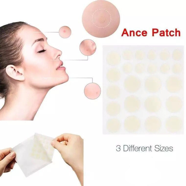Waterproof Hydrocolloid Acne Patches – 24 Spot Covers
