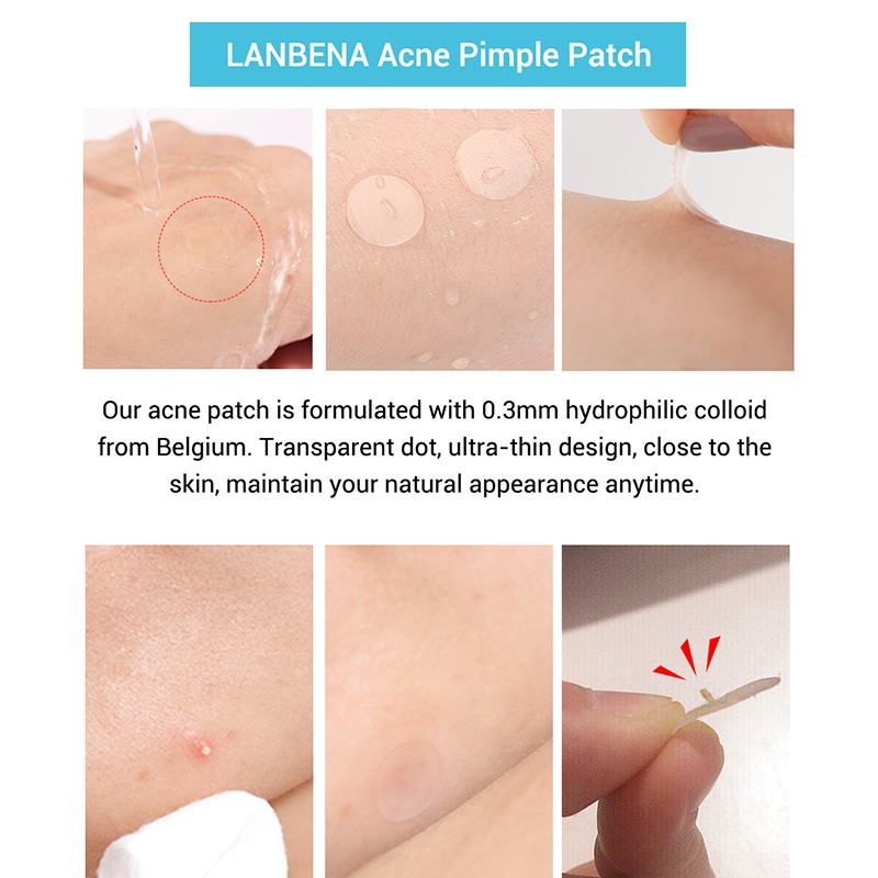 Tea Tree Day & Night Pimple Patches for Acne Marks